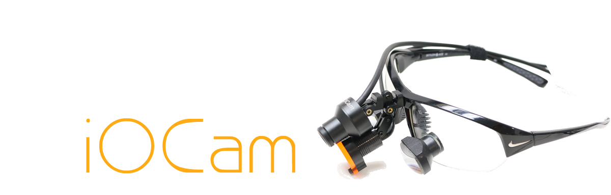 iOCam Loupe Camera